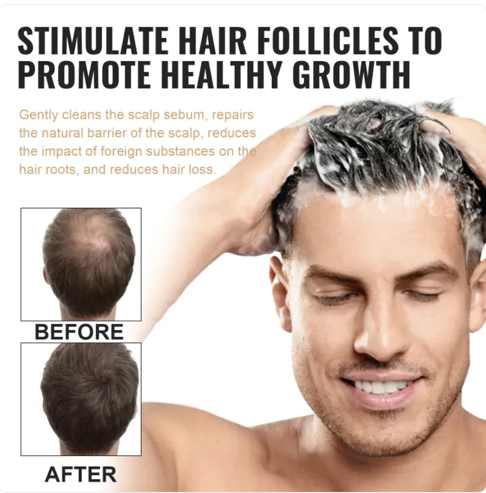 Thick & Fluffy Anti-Hair Loss Repair Shampoo