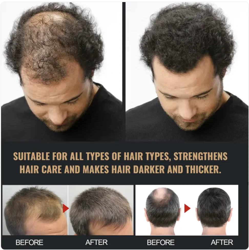 Thick & Fluffy Anti-Hair Loss Repair Shampoo